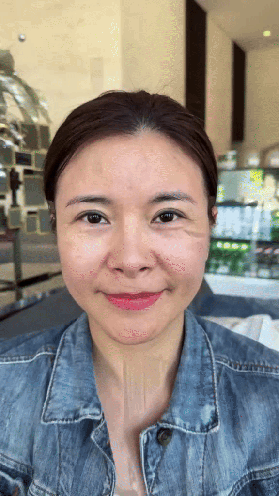 Kim Oanh lên tiếng về phẫu thuật