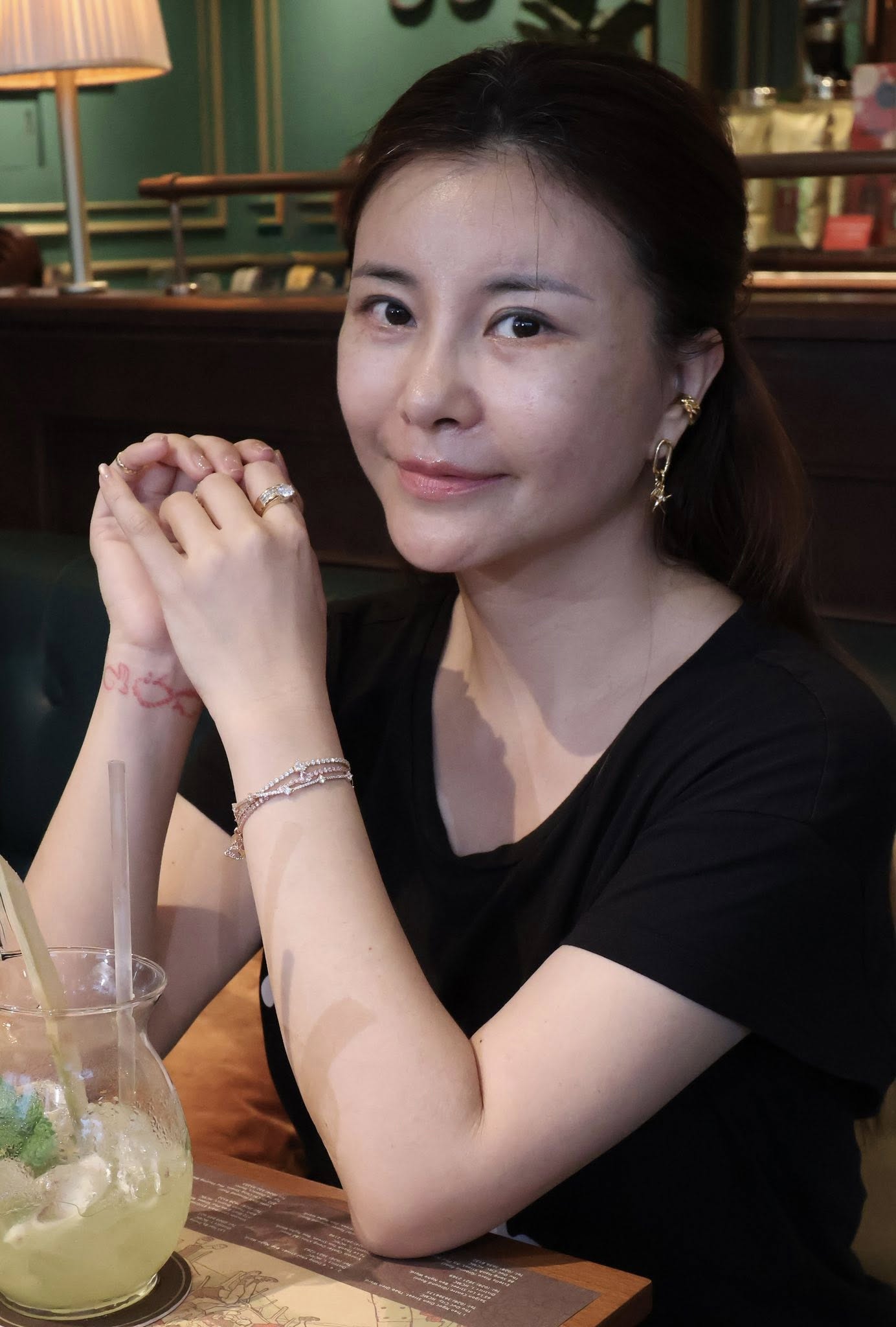 Kim Oanh trước phẫu thuật