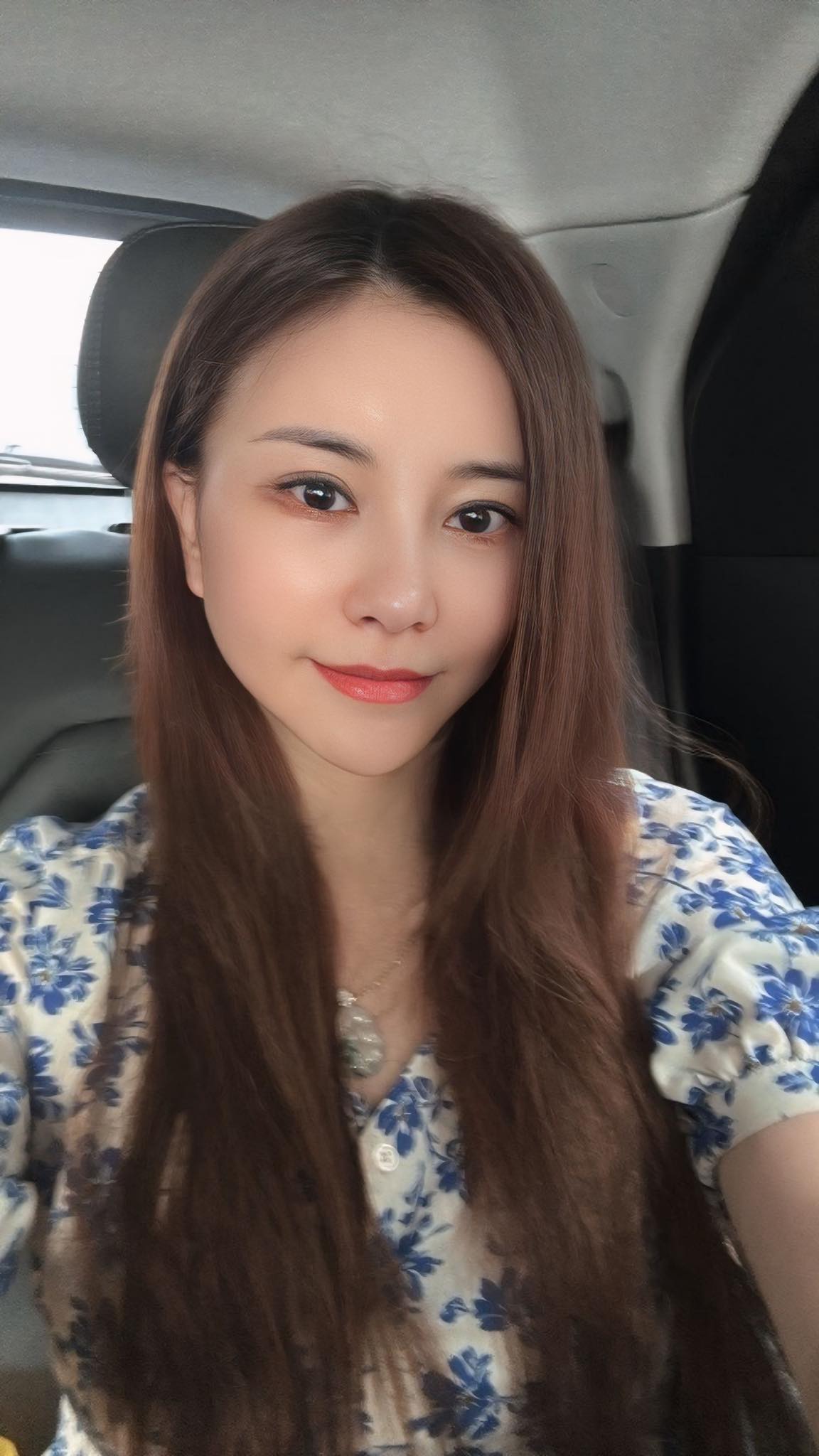 Kim Oanh trước và sau phẫu thuật